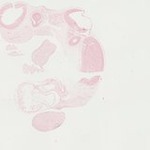 EMAGE:21983