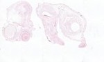 EMAGE:22011