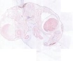 EMAGE:22011