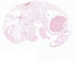 EMAGE:22011