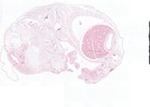 EMAGE:22011
