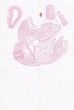 EMAGE:22013