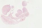 EMAGE:22056