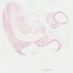 EMAGE:22056