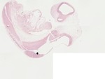 EMAGE:22056