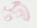 EMAGE:22056