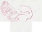 EMAGE:22056