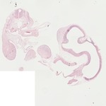 EMAGE:22056