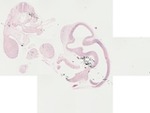 EMAGE:22056