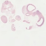 EMAGE:22056