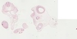 EMAGE:22056