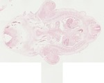 EMAGE:22057