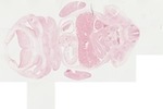 EMAGE:22057