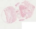 EMAGE:22057