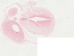 EMAGE:22060