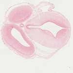 EMAGE:22060