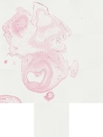 EMAGE:22061