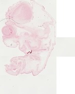EMAGE:22061