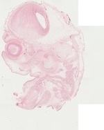 EMAGE:22061