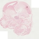 EMAGE:22061