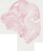 EMAGE:22061
