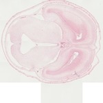 EMAGE:22062