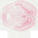EMAGE:22062