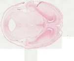 EMAGE:22062