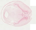 EMAGE:22062