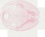 EMAGE:22062