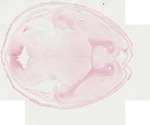 EMAGE:22062