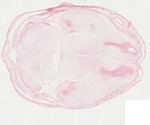 EMAGE:22062