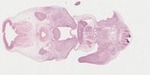 EMAGE:22064