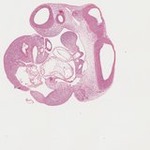 EMAGE:22066