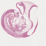 EMAGE:22066