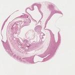 EMAGE:22066