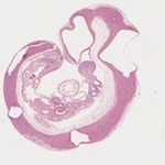 EMAGE:22066