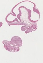 EMAGE:22066