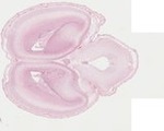 EMAGE:22068