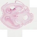 EMAGE:22068