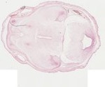 EMAGE:22068