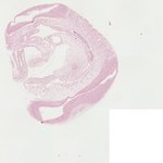 EMAGE:22112