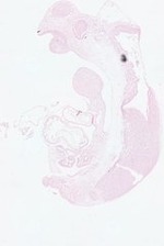 EMAGE:22171