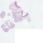EMAGE:22199