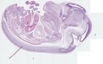 EMAGE:22202