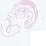 EMAGE:22346