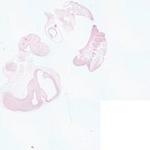 EMAGE:22346