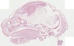 EMAGE:22502