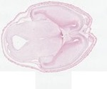 EMAGE:22539
