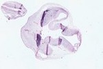 EMAGE:22562